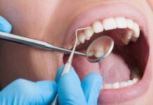 бесплатное лечение зубов