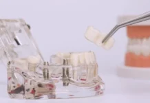 выбор зубного протеза: виды и отличия