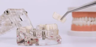 выбор зубного протеза: виды и отличия